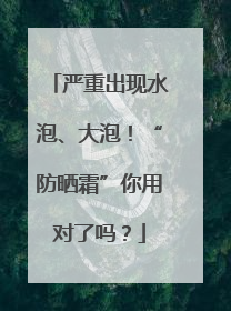 严重出现水泡、大泡！“防晒霜”你用对了吗？